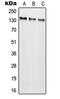 Glutamate Ionotropic Receptor NMDA Type Subunit 2C antibody, MBS821203, MyBioSource, Western Blot image 