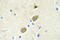 Growth arrest-specific protein 6 antibody, LS-C177065, Lifespan Biosciences, Immunohistochemistry paraffin image 