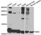 Beta-2-Microglobulin antibody, A12404, ABclonal Technology, Western Blot image 