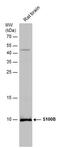 S100 Calcium Binding Protein B antibody, PA5-78161, Invitrogen Antibodies, Western Blot image 
