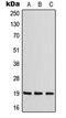 CCHC-Type Zinc Finger Nucleic Acid Binding Protein antibody, MBS820274, MyBioSource, Western Blot image 