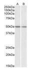 Guanine nucleotide-binding protein G(s) subunit alpha isoforms short antibody, orb20551, Biorbyt, Western Blot image 