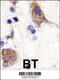 SCY1 Like Pseudokinase 2 antibody, 62-598, ProSci, Immunohistochemistry paraffin image 