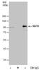 Polycomb protein SUZ12 antibody, PA5-78448, Invitrogen Antibodies, Immunoprecipitation image 