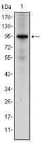 Nuclear Receptor Subfamily 3 Group C Member 1 antibody, GTX60389, GeneTex, Western Blot image 