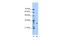 Methyltransferase Like 1 antibody, A10859, Boster Biological Technology, Western Blot image 