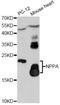 Natriuretic Peptide A antibody, LS-C749737, Lifespan Biosciences, Western Blot image 
