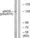Nitric oxide synthase, endothelial antibody, TA314270, Origene, Western Blot image 