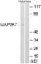 Mitogen-Activated Protein Kinase Kinase 7 antibody, abx012923, Abbexa, Western Blot image 