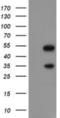 Snail Family Transcriptional Repressor 2 antibody, NBP2-03886, Novus Biologicals, Western Blot image 
