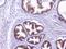 CD46 Molecule antibody, PB9486, Boster Biological Technology, Immunohistochemistry paraffin image 