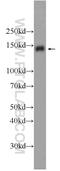 PHD Finger Protein 14 antibody, 24787-1-AP, Proteintech Group, Western Blot image 