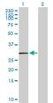 Major Histocompatibility Complex, Class II, DO Alpha antibody, H00003111-D01P, Novus Biologicals, Western Blot image 