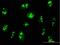 Ribosomal Oxygenase 1 antibody, H00079697-B01P, Novus Biologicals, Immunofluorescence image 