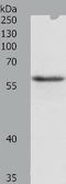 TNF Receptor Associated Factor 6 antibody, TA321663, Origene, Western Blot image 
