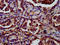 LIF Receptor Subunit Alpha antibody, LS-C670584, Lifespan Biosciences, Immunohistochemistry paraffin image 