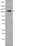 EPH Receptor B1 antibody, PA5-64790, Invitrogen Antibodies, Western Blot image 