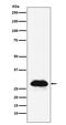 Carbonic Anhydrase 2 antibody, M00143-2, Boster Biological Technology, Western Blot image 