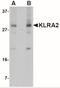 Killer cell lectin-like receptor 2 antibody, NBP2-41096, Novus Biologicals, Western Blot image 