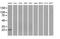 Proteasome 26S Subunit, Non-ATPase 10 antibody, MA5-25016, Invitrogen Antibodies, Western Blot image 