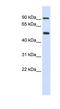 Lysyl Oxidase Like 1 antibody, NBP1-57939, Novus Biologicals, Western Blot image 