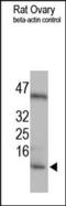 Insulin Like Growth Factor 2 antibody, 250711, Abbiotec, Western Blot image 