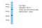 Ubiquitin Specific Peptidase 17 Like Family Member 7 antibody, A16940, Boster Biological Technology, Western Blot image 