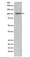 Phosphatidylinositol-4,5-Bisphosphate 3-Kinase Catalytic Subunit Alpha antibody, M00029, Boster Biological Technology, Western Blot image 