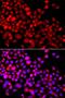 Calcium-binding and coiled-coil domain-containing protein 1 antibody, PA5-76320, Invitrogen Antibodies, Immunofluorescence image 