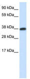 DMRT Like Family C2 antibody, TA329946, Origene, Western Blot image 