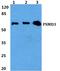 Proteasome 26S Subunit, Non-ATPase 3 antibody, A08767-1, Boster Biological Technology, Western Blot image 