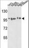 Actinin Alpha 4 antibody, LS-C96727, Lifespan Biosciences, Western Blot image 