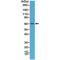 Protein Kinase AMP-Activated Catalytic Subunit Alpha 1 antibody, M00994-1, Boster Biological Technology, Western Blot image 