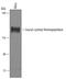 Leucyl-cystinyl aminopeptidase antibody, AF6386, R&D Systems, Western Blot image 