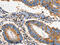 FAS antibody, CSB-PA185779, Cusabio, Immunohistochemistry paraffin image 