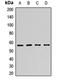 N-Myristoyltransferase 2 antibody, LS-C668501, Lifespan Biosciences, Western Blot image 