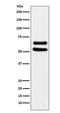 IKAROS Family Zinc Finger 1 antibody, M00531-1, Boster Biological Technology, Western Blot image 