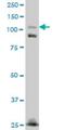Fibronectin Type III Domain Containing 3A antibody, H00022862-M01, Novus Biologicals, Western Blot image 