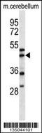 Actin Related Protein 1A antibody, 58-272, ProSci, Western Blot image 