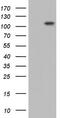 Procollagen-Lysine,2-Oxoglutarate 5-Dioxygenase 2 antibody, M04601, Boster Biological Technology, Western Blot image 