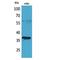 CD207 Molecule antibody, LS-C387033, Lifespan Biosciences, Western Blot image 