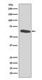 Histone Deacetylase 2 antibody, M00325, Boster Biological Technology, Western Blot image 