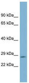 Growth Hormone 2 antibody, TA329466, Origene, Western Blot image 