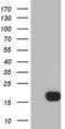 TFF1 antibody, LS-C793878, Lifespan Biosciences, Western Blot image 