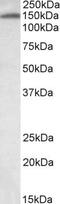 Inter-Alpha-Trypsin Inhibitor Heavy Chain 4 antibody, NBP1-78286, Novus Biologicals, Western Blot image 