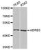 Adrenoceptor Beta 3 antibody, A8607, ABclonal Technology, Western Blot image 