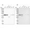 Protein Phosphatase 1 Regulatory Subunit 8 antibody, PA5-55605, Invitrogen Antibodies, Western Blot image 