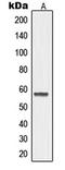 Matrix Metallopeptidase 19 antibody, LS-C352535, Lifespan Biosciences, Western Blot image 