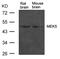 Mitogen-Activated Protein Kinase Kinase 5 antibody, 79-696, ProSci, Western Blot image 
