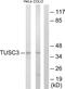 Tumor Suppressor Candidate 3 antibody, GTX87753, GeneTex, Western Blot image 